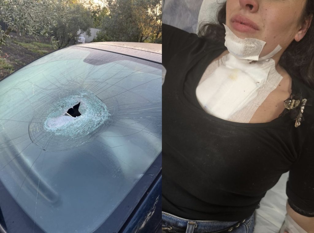 Sassi contro auto sulle statali vesuviane: feriti e paura, è allarme