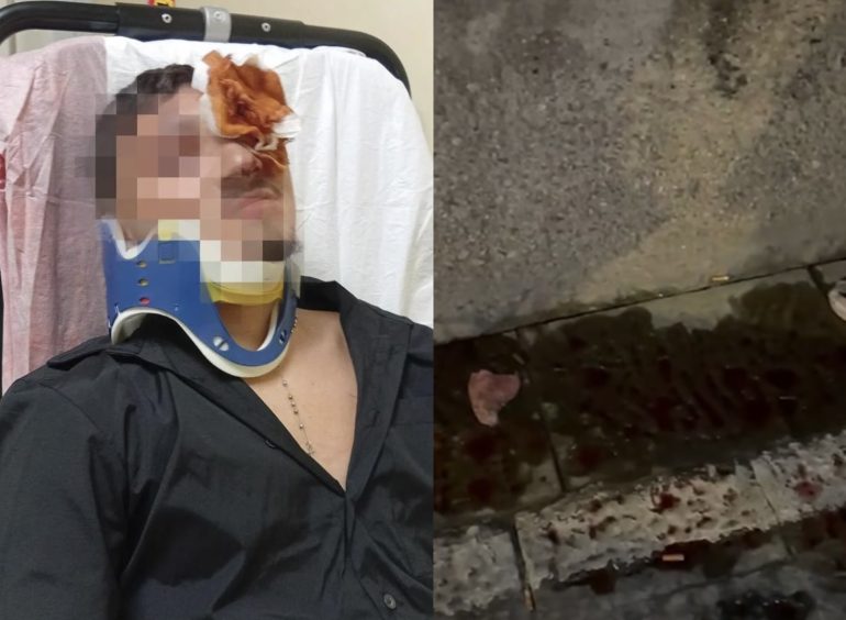 Portici, il 16enne massacrato per gelosia: denunciato un ragazzo di 14 anni