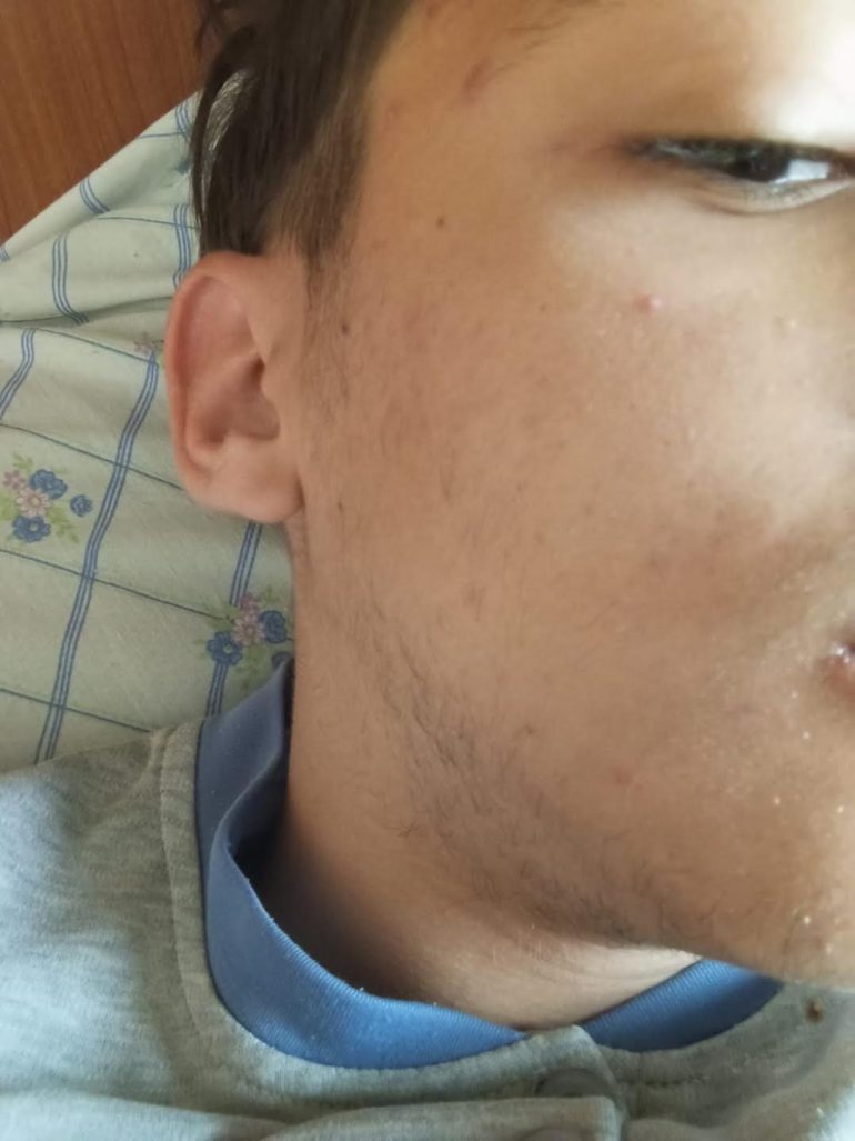 Napoli, minorenne rapinato e colpito con un pugno a Piazza Garibaldi