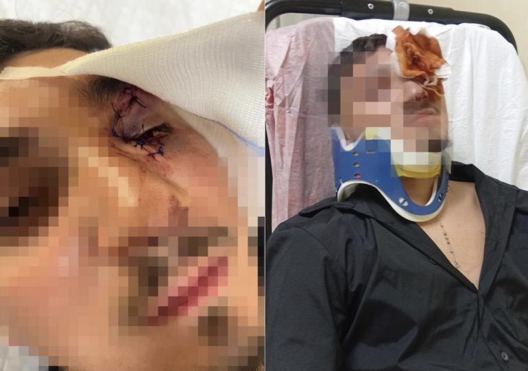 Portici, massacrato a 16 anni dal branco per un saluto