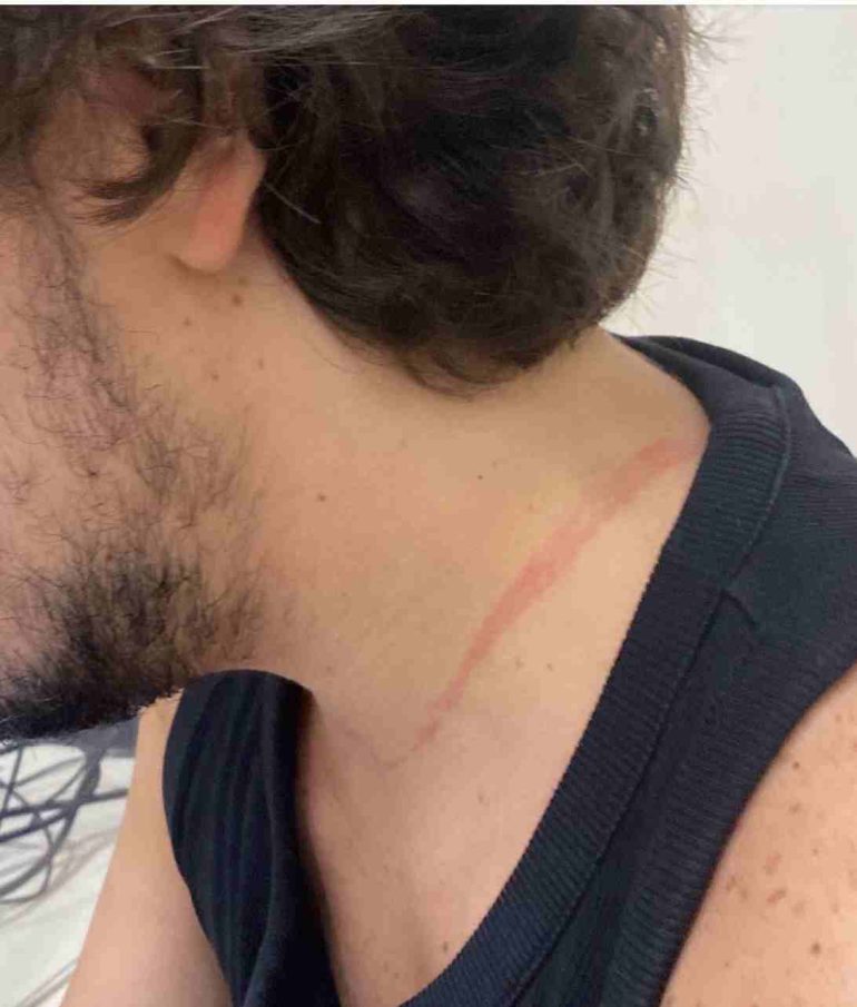 Baby Gang scatenata al Pizza Village: rapine e violenza “Mancano i controlli”