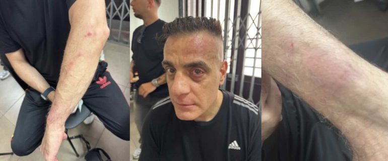Napoli, lo youtuber Cicalone aggredito a bastonate alla Stazione Centrale