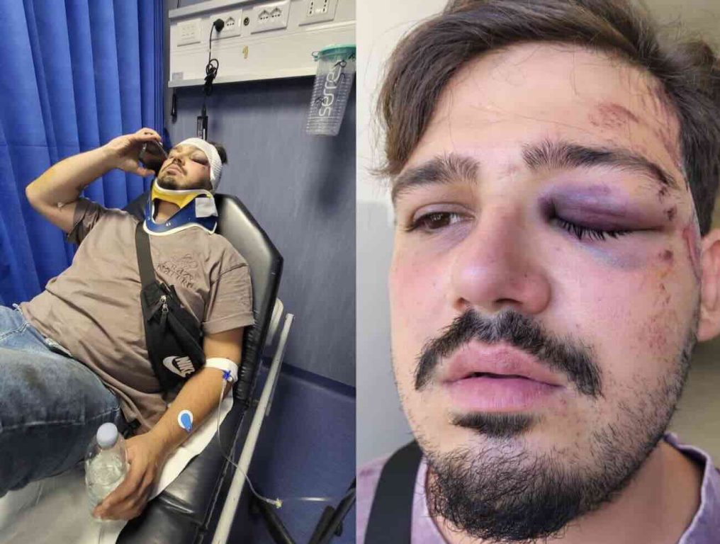 Ciclista investito nella Galleria Vittoria: è caccia al pirata della strada