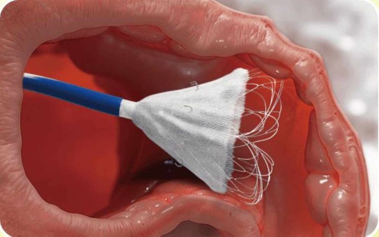 Eukon porta in Italia due nuove tecnologie per la cardiologia: accordi con Shenqi e Cardiac Dimensions