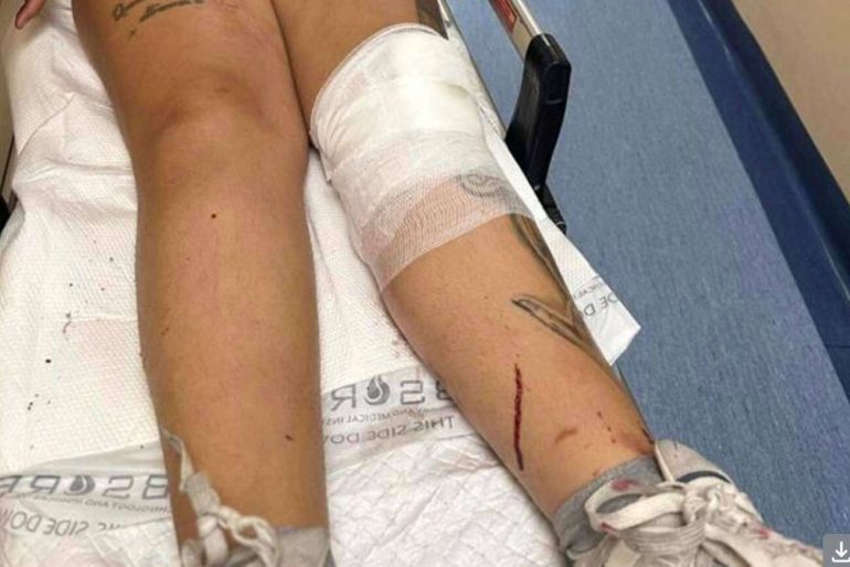 Nella foto, un elemento rappresentativo della vicenda.