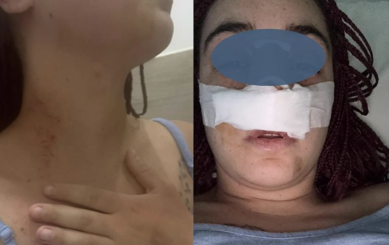 Dramma a Brusciano: sfregiata 2 volte dal marito, salvata dal “gesto” disperato della figlia minore