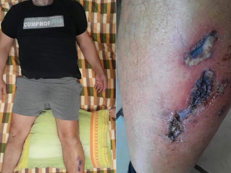 Nella foto, un particolare della vicenda.