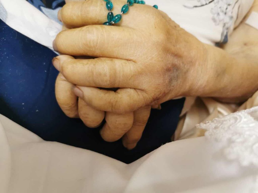 Napoli, muore all’ ospedale San Paolo, sparisce la fede nuziale: la famiglia denuncia