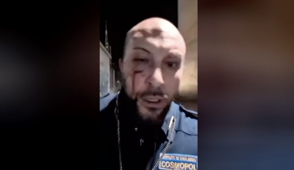 Poggiomarino, guardia giurata massacrata per difendere il nuovo treno Eav: «Ecco chi mi ha ridotto così»