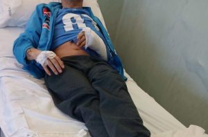 Aggressione al Policlinico di Napoli, addetto alle pulizie picchiato dopo un rifiuto di servizio