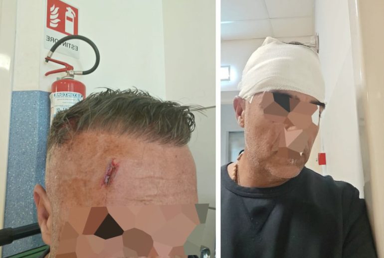 Chiede il biglietto, viene colpito alla testa con un cellulare: aggredito autista Air Campania