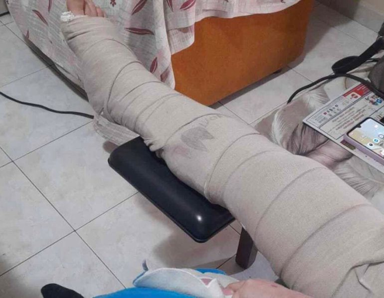 Anziana operata alla rotula, ma il gesso resta oltre i tempi: la denuncia di Borrelli (Avs)