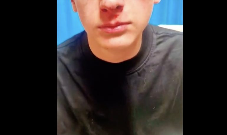 Far West a Fuorigrotta: 15enne pestato dal branco prima di Pasqua