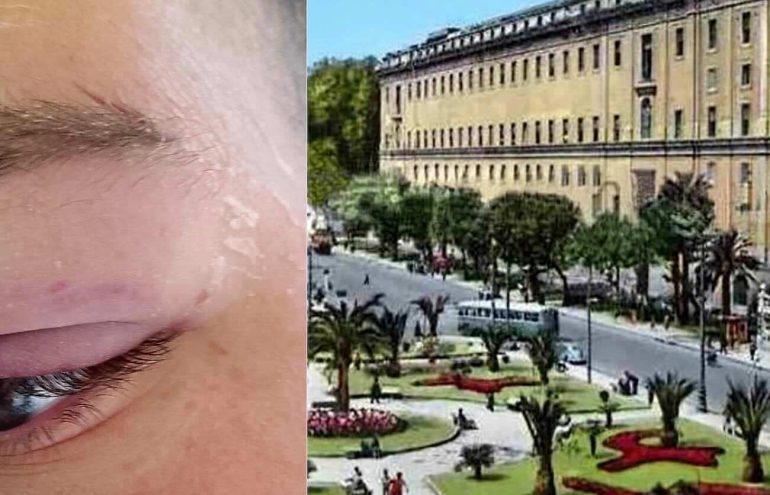 Piazza Carlo III, studente aggredito da una baby gang