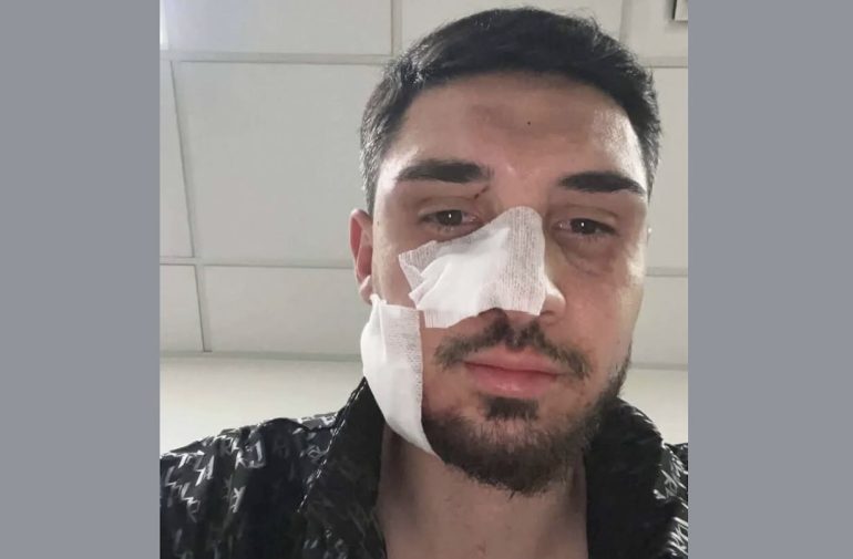 Asse Mediano, calciatore aggredito e ferito dopo un tamponamento