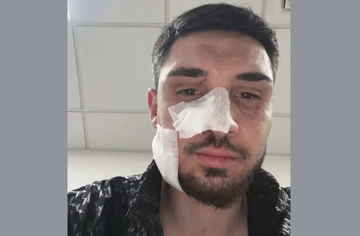 Panico sull’Asse Mediano: calciatore aggredito e ferito dopo tamponamento