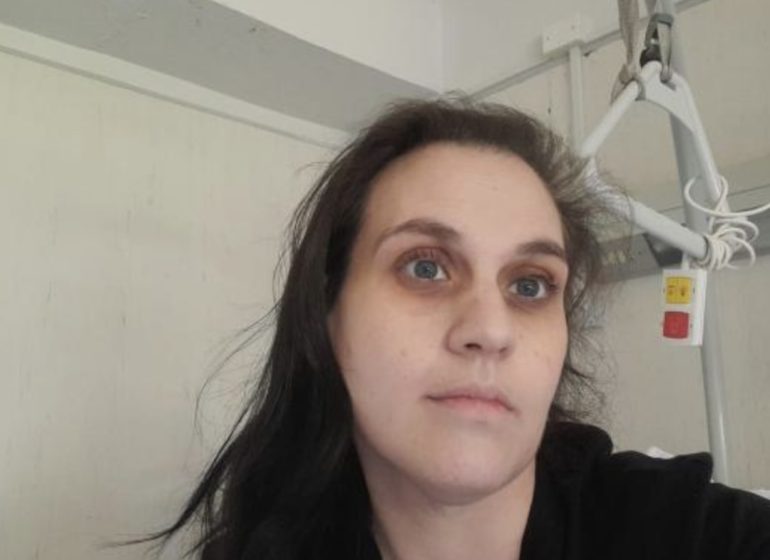 Caso di Angela Iannotta, i periti accusano: «Errore nel post-operatorio»