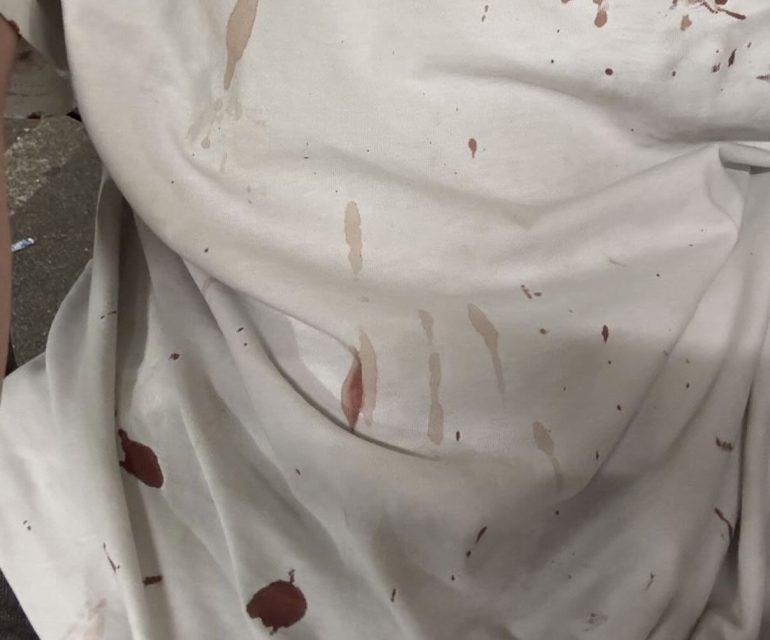 Violenza tra giovanissimi a Volla: dodicenne aggredito dal branco in strada