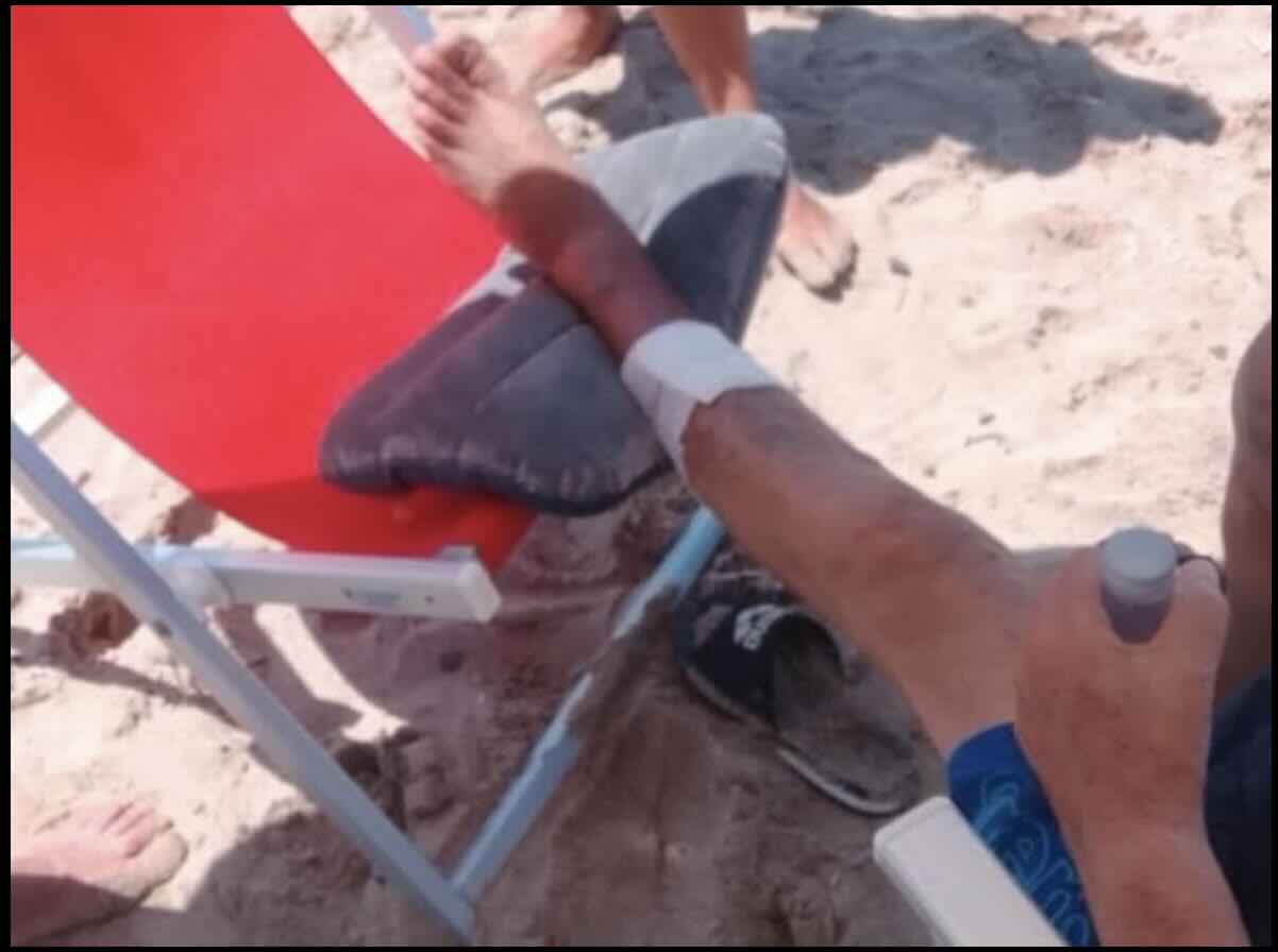 Allarme nel Cilento: Due turisti feriti da morsi di pesci in pochi giorni