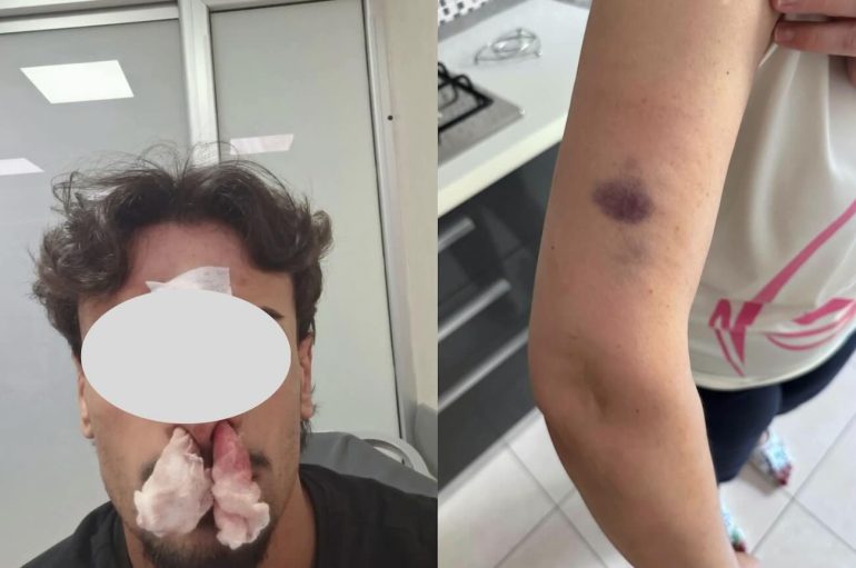 Casoria, aggrediti in casa per il parcheggio disabili. La madre: «Mio figlio ha fatto da scudo col suo corpo»